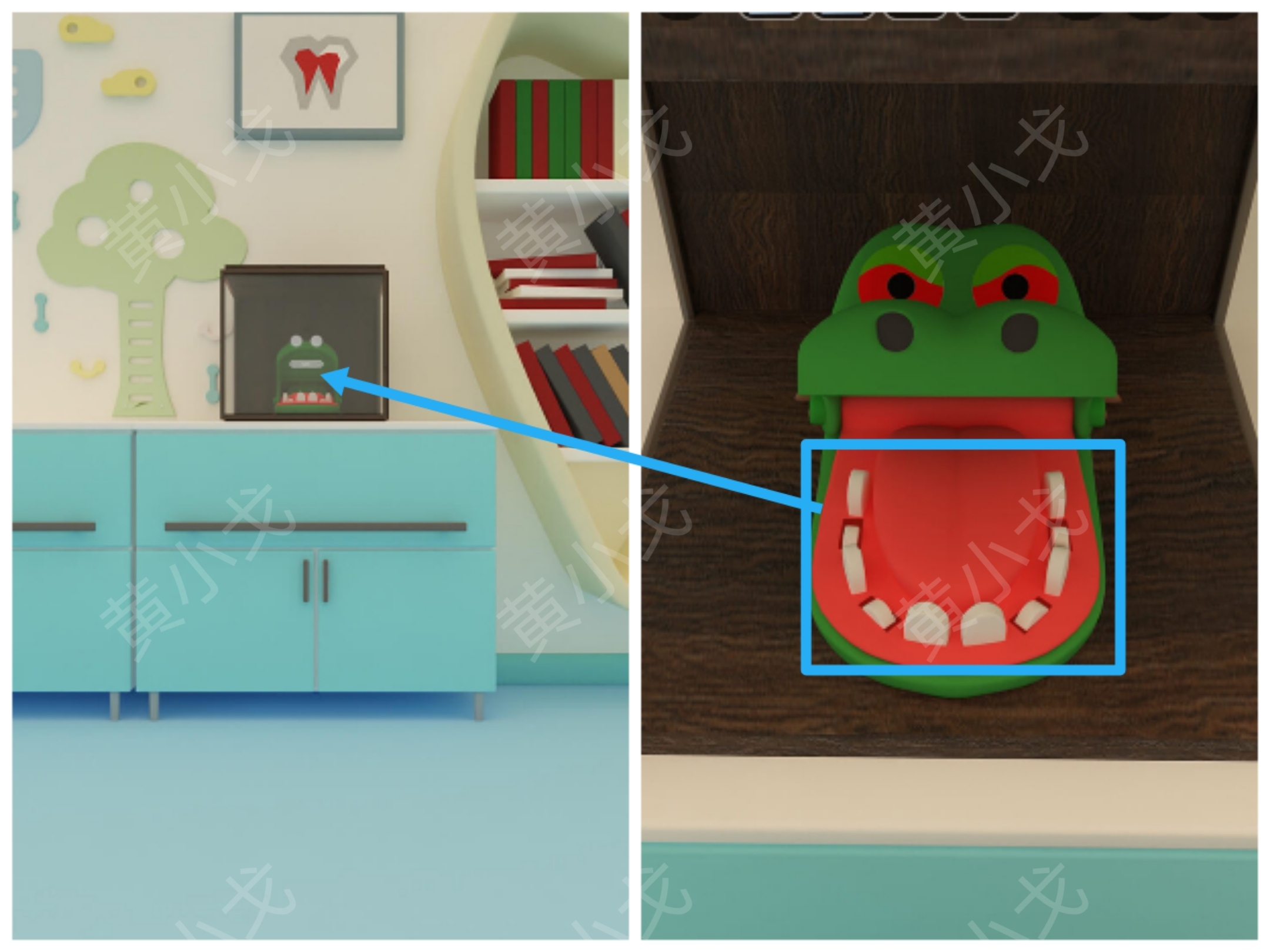 Escape Room：Dental（密室逃脱：牙科诊所）攻略（一）